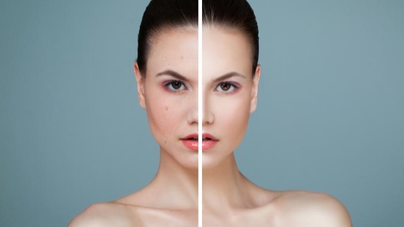 Differences between Facial and Cleanup