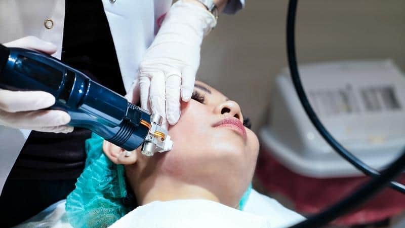 What is Microneedling